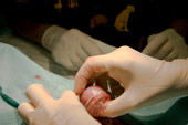 Intervención quirúrgica
